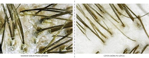 Przejdź do produktu MAGMARI peeling do skóry głowy PELUDO 200 ml